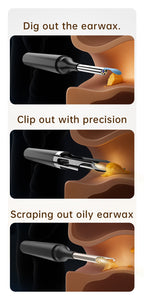 10MP HD Ear Cleaner Kit with Precision Tweezers & Silicone Scoop